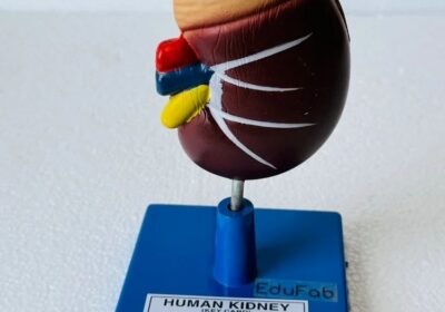 HUMAN-KIDNEY-LARGE-ON-STAND